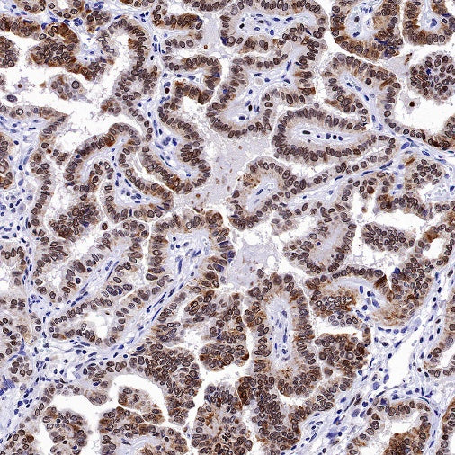 H2AFY Recombinant Rabbit mAb (S-1256-35)