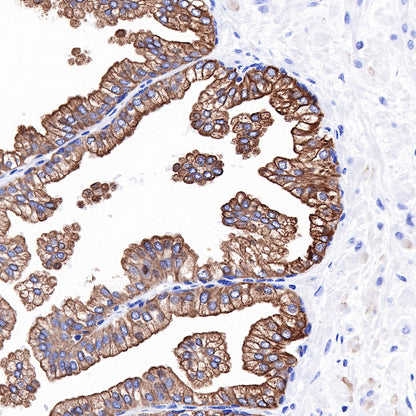 S-RMab® Keratin 18 Recombinant Rabbit mAb (SDT-012-7)
