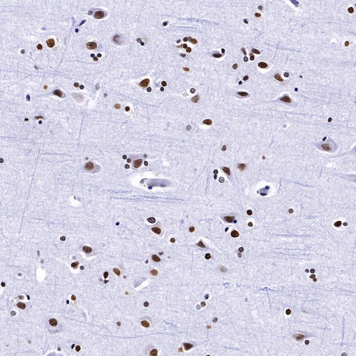 Histone H2B Recombinant Rabbit mAb (S-R214)