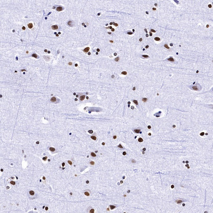 Histone H2B Recombinant Rabbit mAb (S-R214)