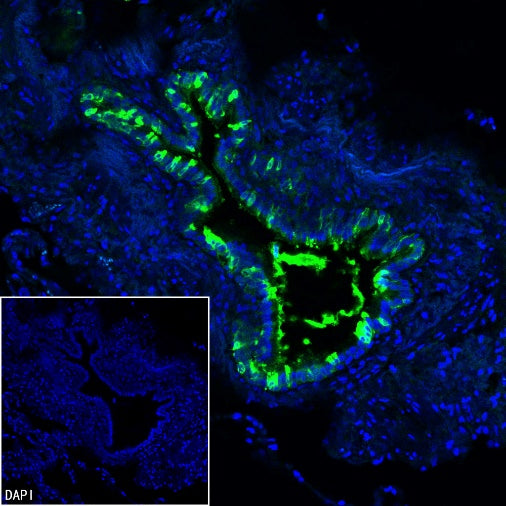 Uteroglobin Recombinant Rabbit mAb (SDT-2736-46)