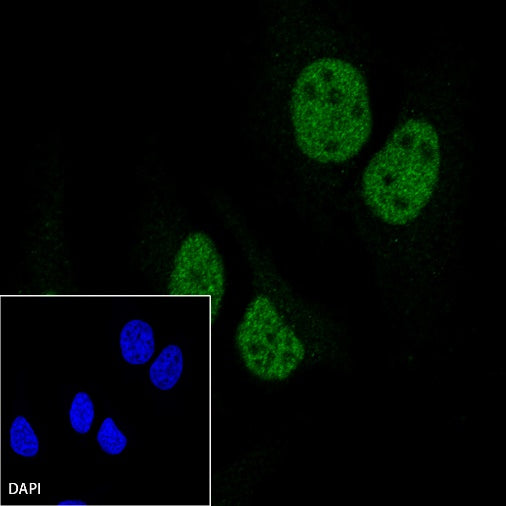 MLH1 Recombinant Rabbit mAb (SDT-112-50)