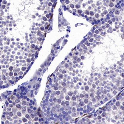 LIN28A Rabbit Polyclonal Antibody