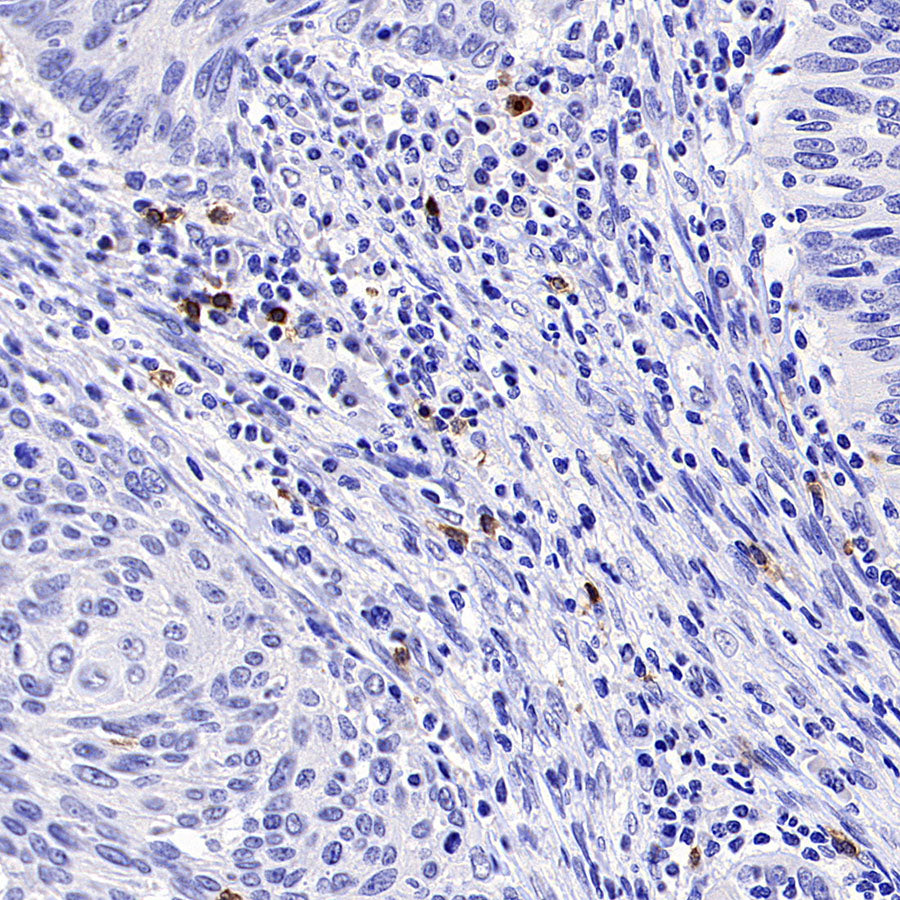 TRDC/TCR delta Recombinant Rabbit mAb (S-5148)