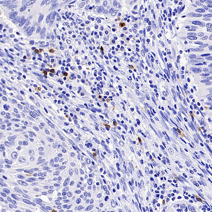 TRDC/TCR delta Recombinant Rabbit mAb (S-5148)