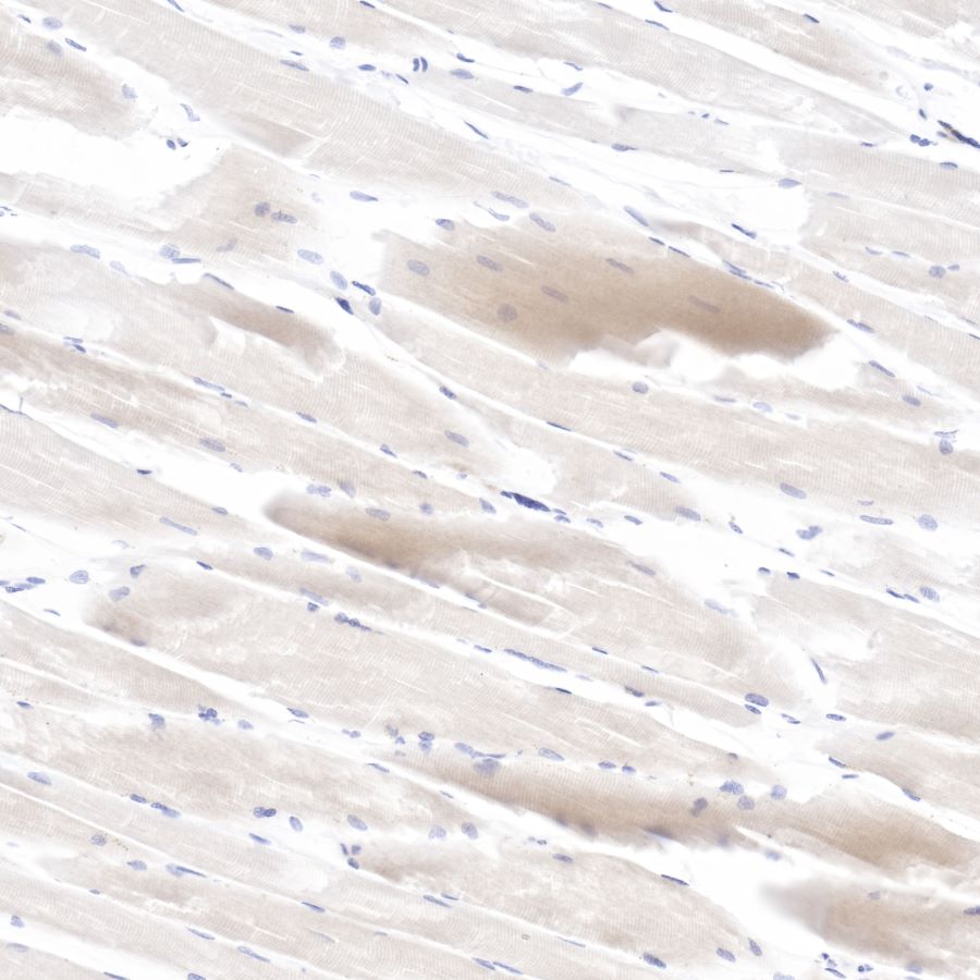 pan (alpha) actin Recombinant Rabbit mAb (SDT-044-17)