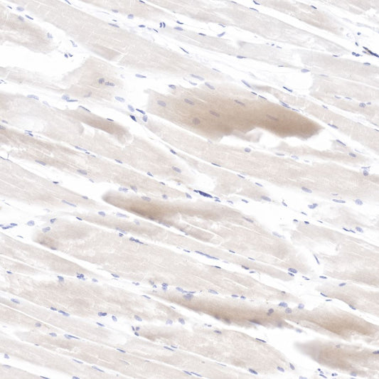 pan (alpha) actin Recombinant Rabbit mAb (SDT-044-17)