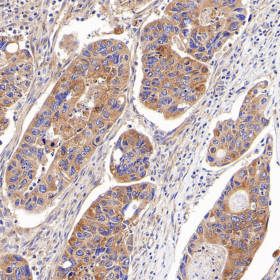 AP-2α Recombinant Rabbit mAb (S-4444-44)