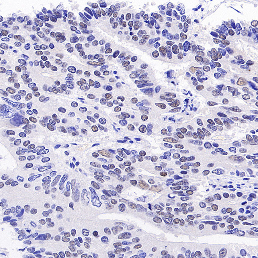 Phospho-ATM (Ser1981) Recombinant Rabbit mAb (S-3396)