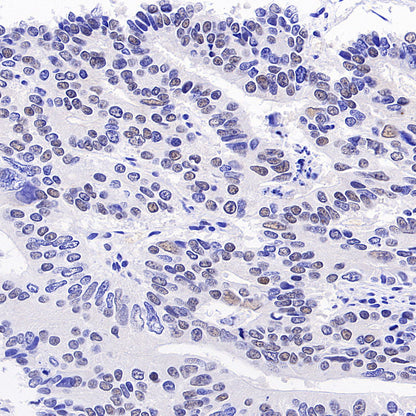 Phospho-ATM (Ser1981) Recombinant Rabbit mAb (S-3396)