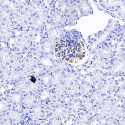 VEGF Receptor 2/FLK-1 Recombinant Rabbit mAb (SDT-1519-144)