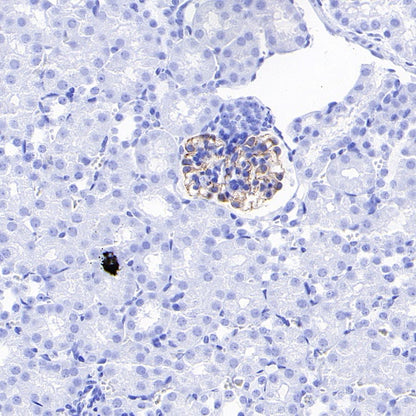 VEGF Receptor 2/FLK-1 Recombinant Rabbit mAb (SDT-1519-144)