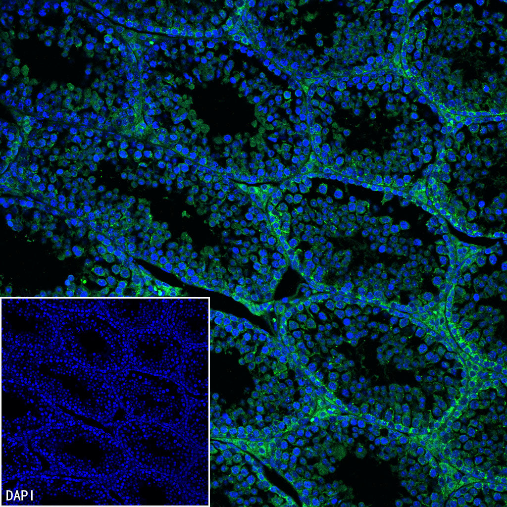 DOCK11 Recombinant Rabbit mAb (S-4420-57)