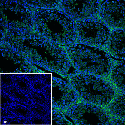 DOCK11 Recombinant Rabbit mAb (S-4420-57)