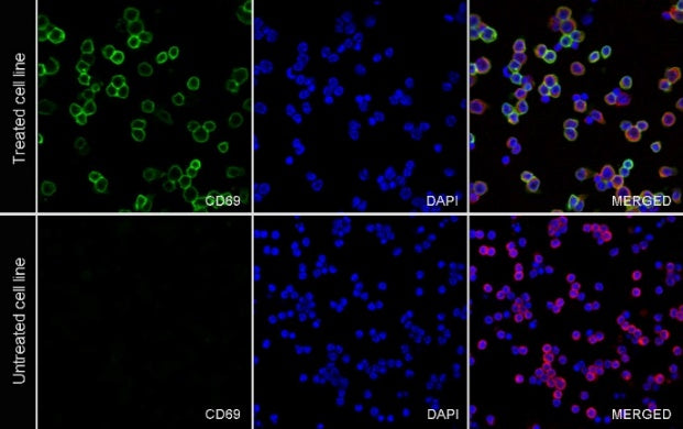 CD69 Recombinant Rabbit mAb (S-3362)