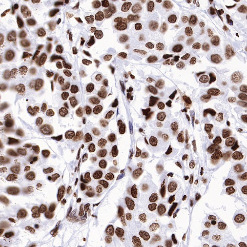 Histone H3 (mono methyl K36) Recombinant Rabbit mAb (S-R211)