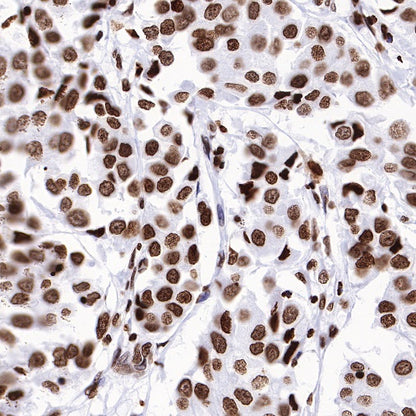 Histone H3 (mono methyl K36) Recombinant Rabbit mAb (S-R211)