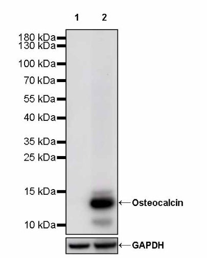 Osteocalcin Recombinant Rabbit mAb ,PBS Only (SDT-2311-37)