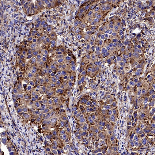 CD107b/LAMP2 Recombinant Mouse mAb (H4B4)