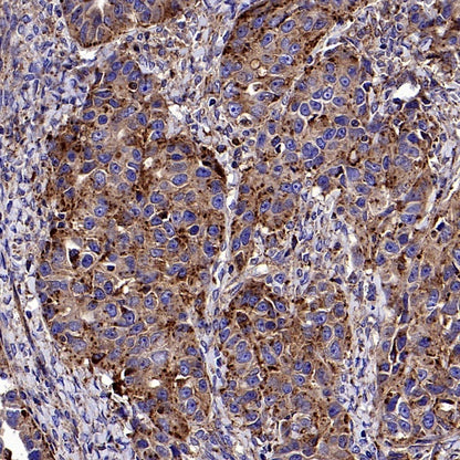 CD107b/LAMP2 Recombinant Mouse mAb (H4B4)