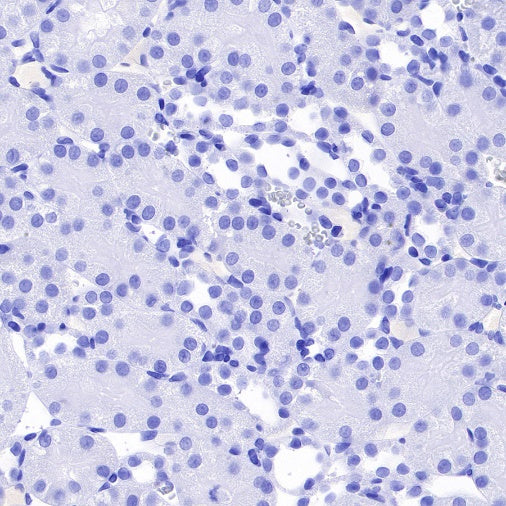 α-Synuclein Recombinant Rabbit mAb (S-441-86)