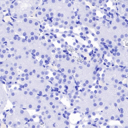 α-Synuclein Recombinant Rabbit mAb (S-441-86)