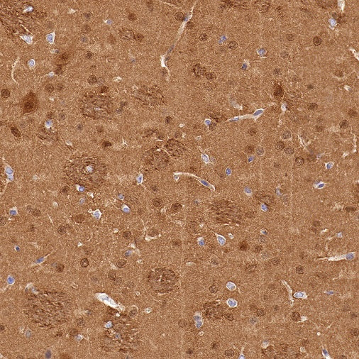 UCHL1 Recombinant Rabbit mAb (S-1765-38)