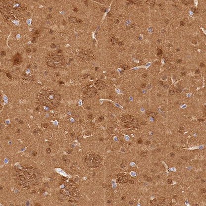UCHL1 Recombinant Rabbit mAb (S-1765-38)