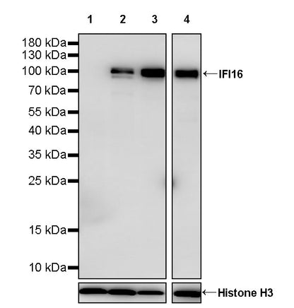IFI16 Recombinant Rabbit mAb (S-4089-44)