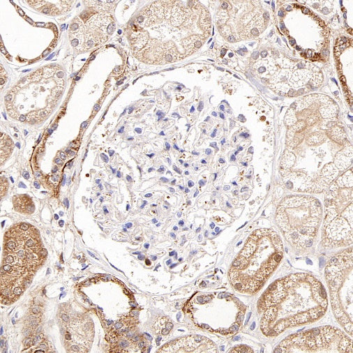 PPIF/Cyclophilin F Recombinant Rabbit mAb (S-2043-61)