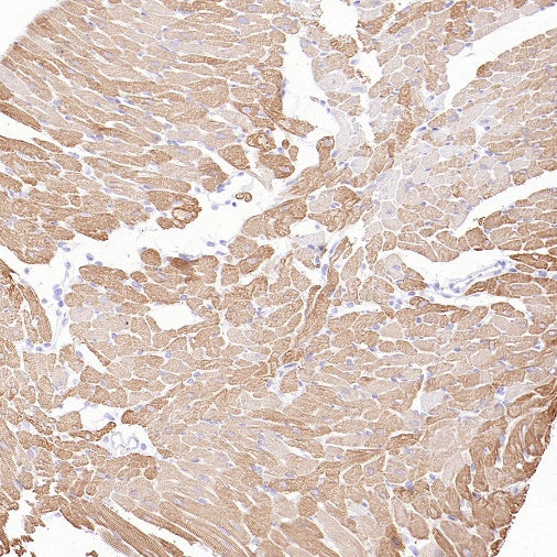 MYH7 Recombinant Rabbit mAb (SDT-2936-44)