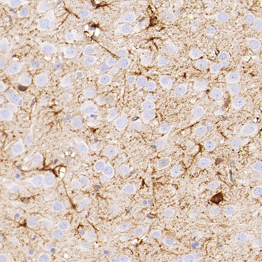 PITX2 Recombinant Rabbit mAb (S-4009-54)