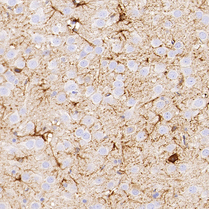 PITX2 Recombinant Rabbit mAb (S-4009-54)