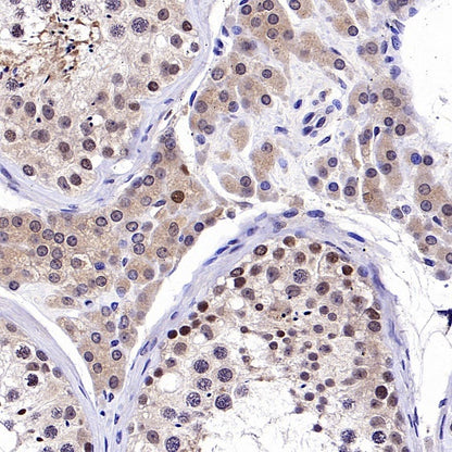 FOXM1 Recombinant Rabbit mAb (S-2529-26)