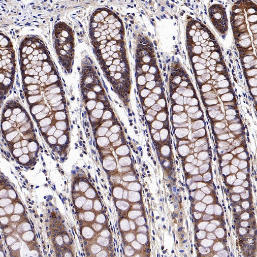 Src Recombinant Rabbit mAb (S-1181-16)