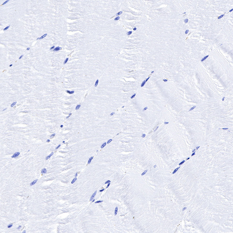 Smooth Muscle Myosin Heavy Chain (SMMHC) Recombinant Rabbit mAb (SDT-R089)