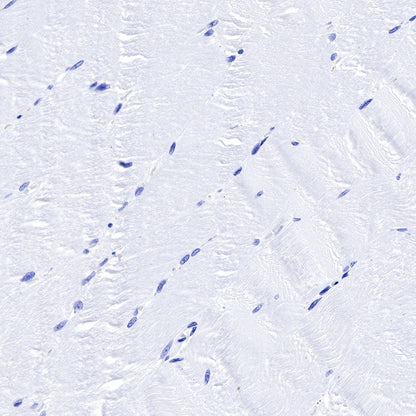Smooth Muscle Myosin Heavy Chain (SMMHC) Recombinant Rabbit mAb (SDT-R089)