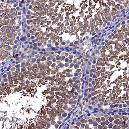 Park7/DJ-1 Recombinant Rabbit mAb (S-980-144)