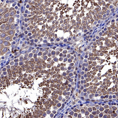 Park7/DJ-1 Recombinant Rabbit mAb (S-980-144)