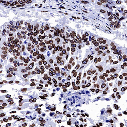 Lamin A Recombinant Rabbit mAb (S-1503-44)