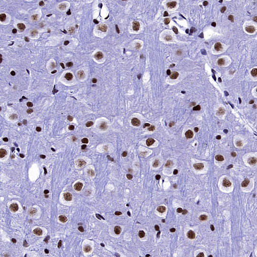 WTAP Recombinant Rabbit mAb (S-2741-49)