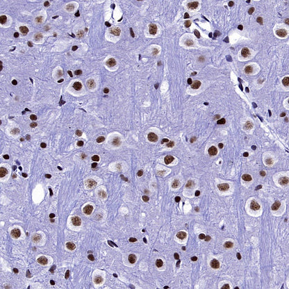 WTAP Recombinant Rabbit mAb (S-2741-49)