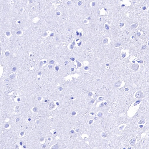 IMP-3 Recombinant Rabbit mAb (S-439-10)