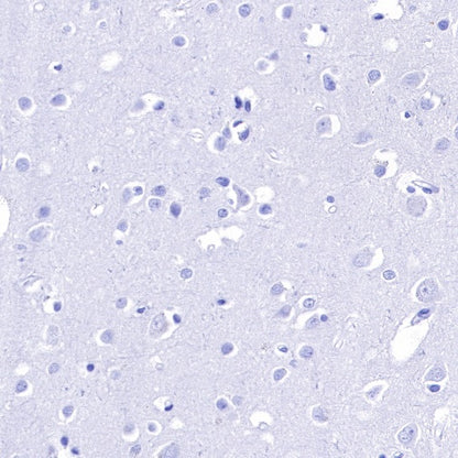 IMP-3 Recombinant Rabbit mAb (S-439-10)