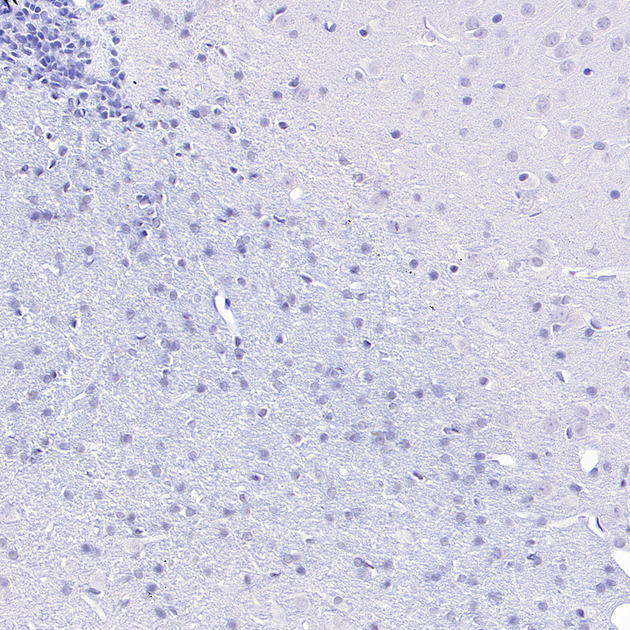 Olfactory Marker/OMP Recombinant Rabbit mAb (S-3513-32)