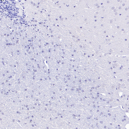 Olfactory Marker/OMP Recombinant Rabbit mAb (S-3513-32)