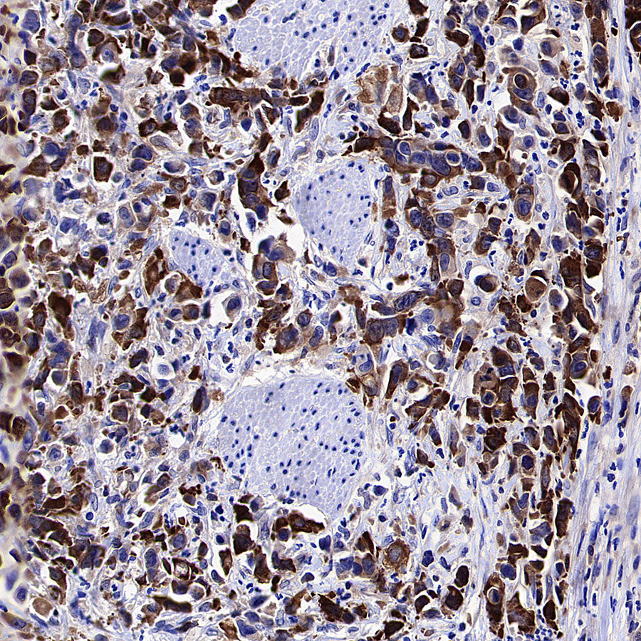 HSP90 alpha/beta Recombinant Mouse mAb (S-5282)