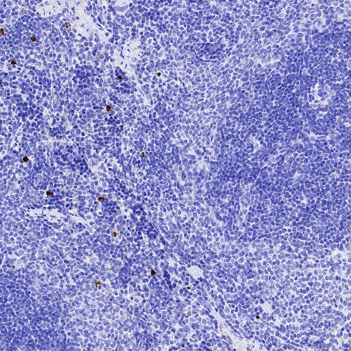 Olfm4 Recombinant Rabbit mAb (S-2748-67)