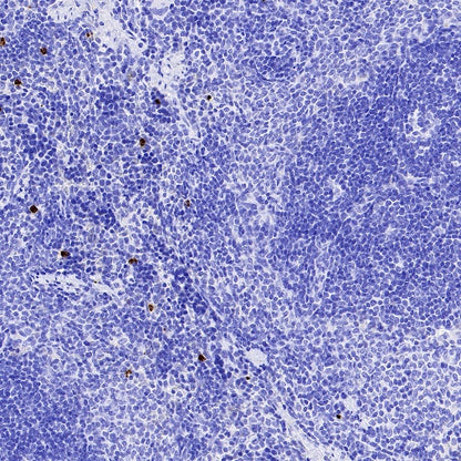 Olfm4 Recombinant Rabbit mAb (S-2748-67)