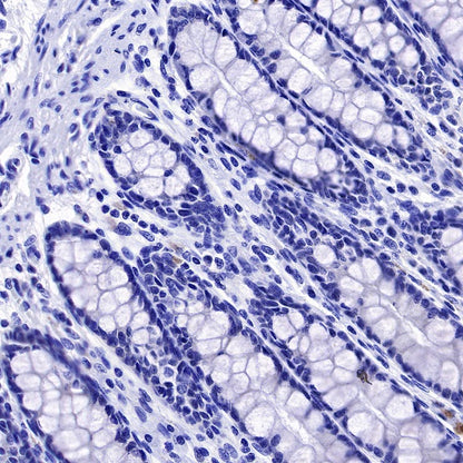 TrkB Recombinant Rabbit mAb (S-488-5)